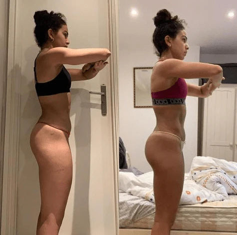 Before and after results using Smart EMS Sculp and Lift Kit for butt lift