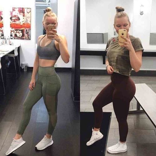 Before and after results using Smart EMS Sculp and Lift Kit for butt lift